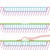 NPSD1000 Dressing Kits foreking