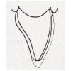 Non Prep Veneers