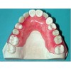 Removable Prosthetic Valplast Denture