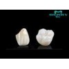 Adhesive Bridge Porcelain Dental Crowns Glass porcelain Material