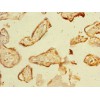 NHLRC2 Antibody