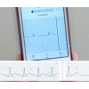 ECG MonitorBest service ecg holter monitor